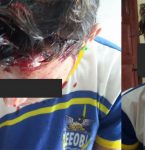 Estudante é agredido após sofrer tentativa de assalto em Capanema