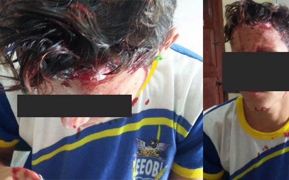 Estudante é agredido após sofrer tentativa de assalto em Capanema