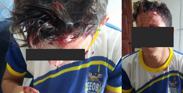 Estudante é agredido após sofrer tentativa de assalto em Capanema