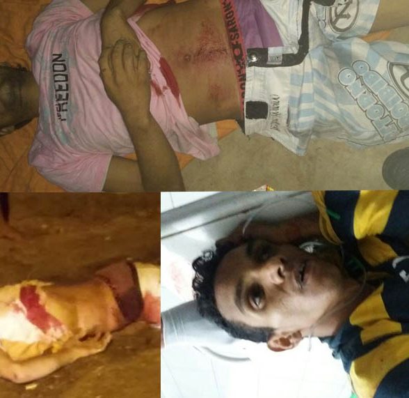 Dois homicá­dios foram registrados em Capanema na madrugada deste Domingo (19)