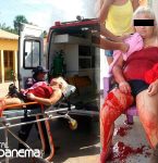 Marido traá­do tenta matar mulher a facadas em Capanema