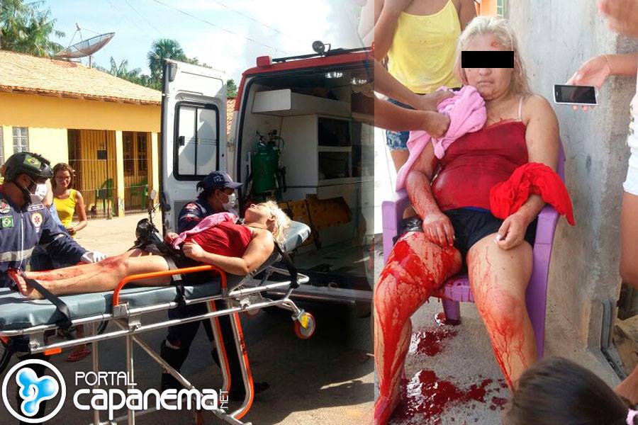 Marido traá­do tenta matar mulher a facadas em Capanema