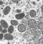 Brasil tem 592 casos confirmados de vará­ola dos macacos; veja lista de sintomas e como se proteger