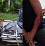 Ribeirinho é atingido por moto aquática na Ilha do Combu, em Belém