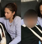 Governo de Portugal investiga caso de filho de paraense que teve dedos mutilados em escola