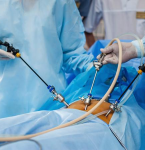 Pará participa de mutirão de cirurgias bariátricas; saiba mais